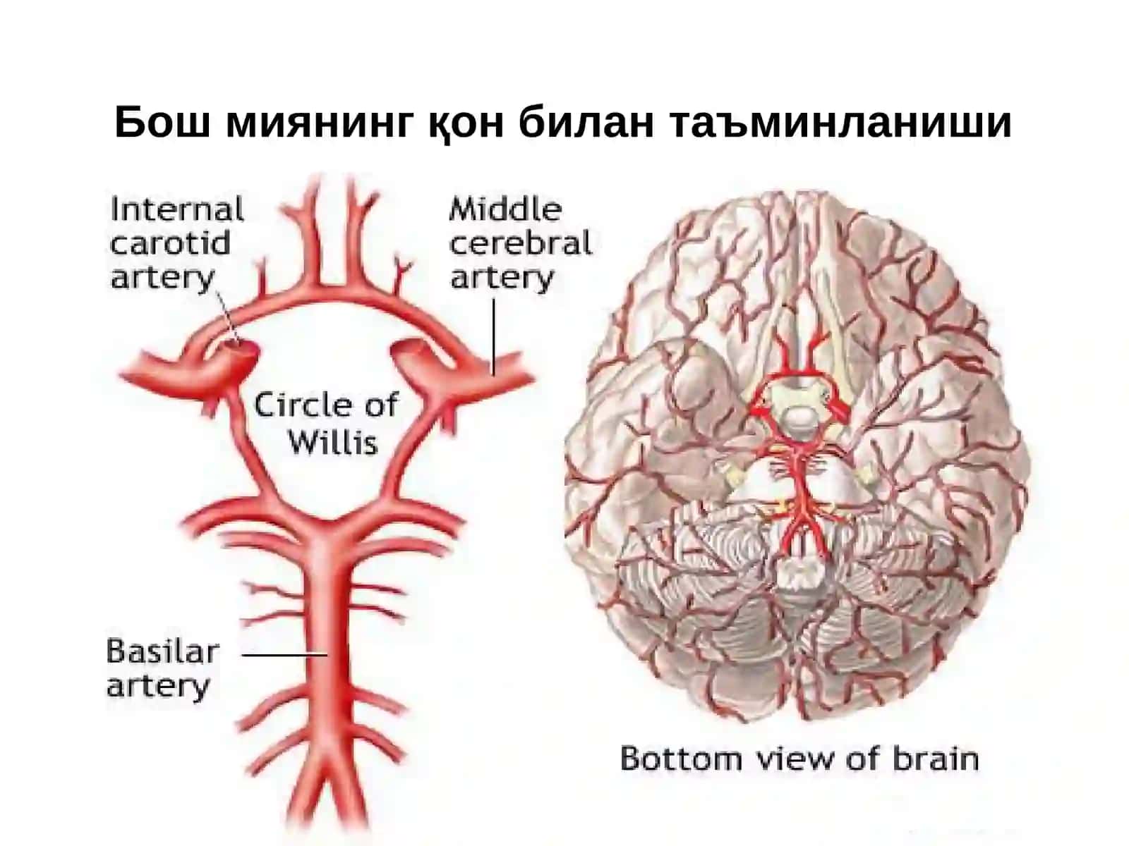 Ўткир мия ишемияси 2