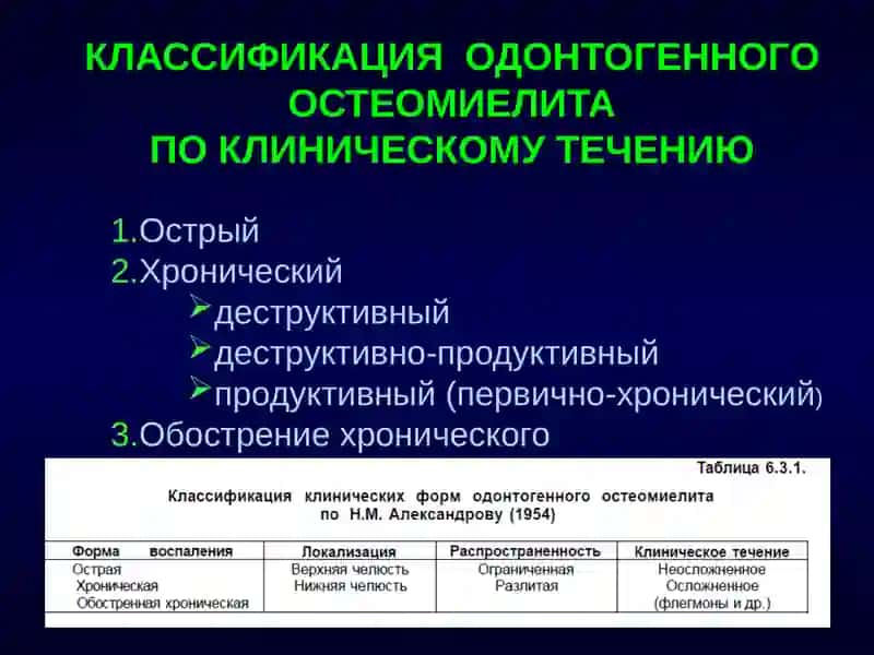 Остеомиелит 2