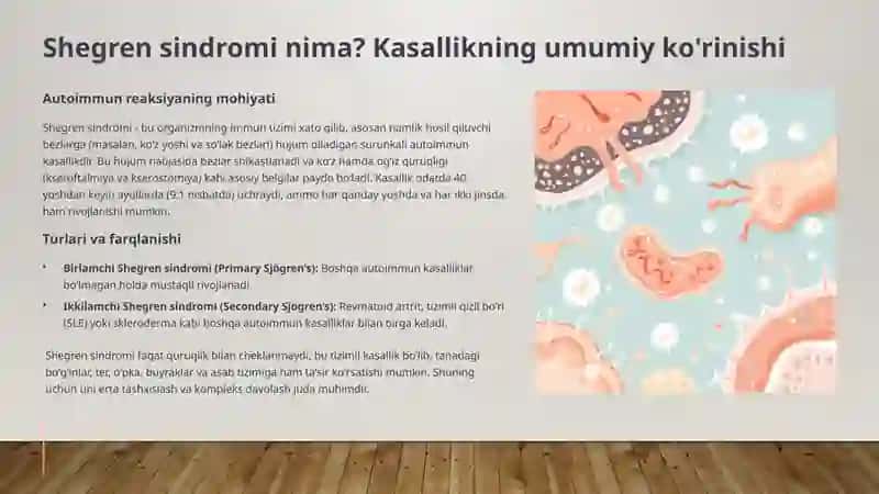 Shegren Sindromi 2