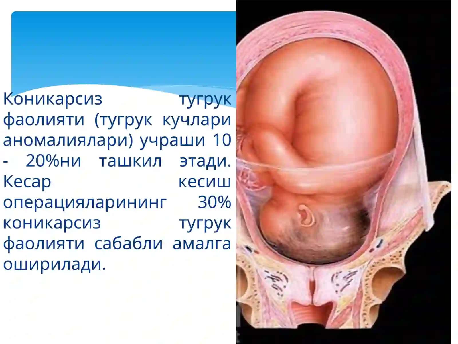 Кесар кесиш операциялари ва туғруқни бошқариш 2