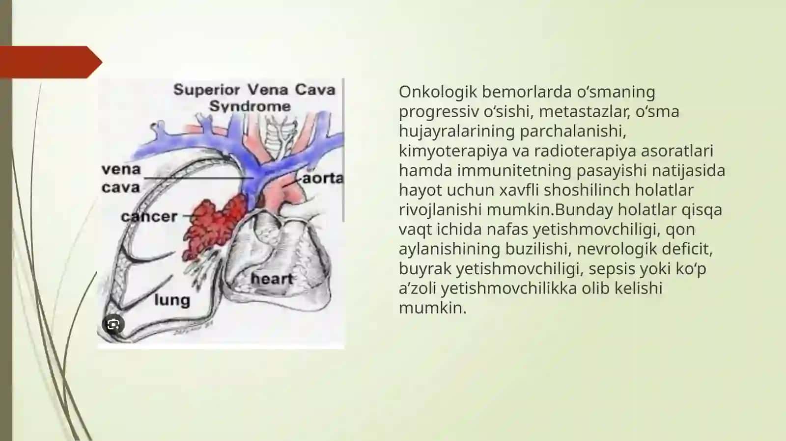 Onkologik bemorlarda uchraydigan shoshilin chholatlar 2