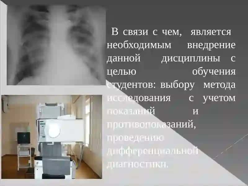 Дифференциальная диагностика 2