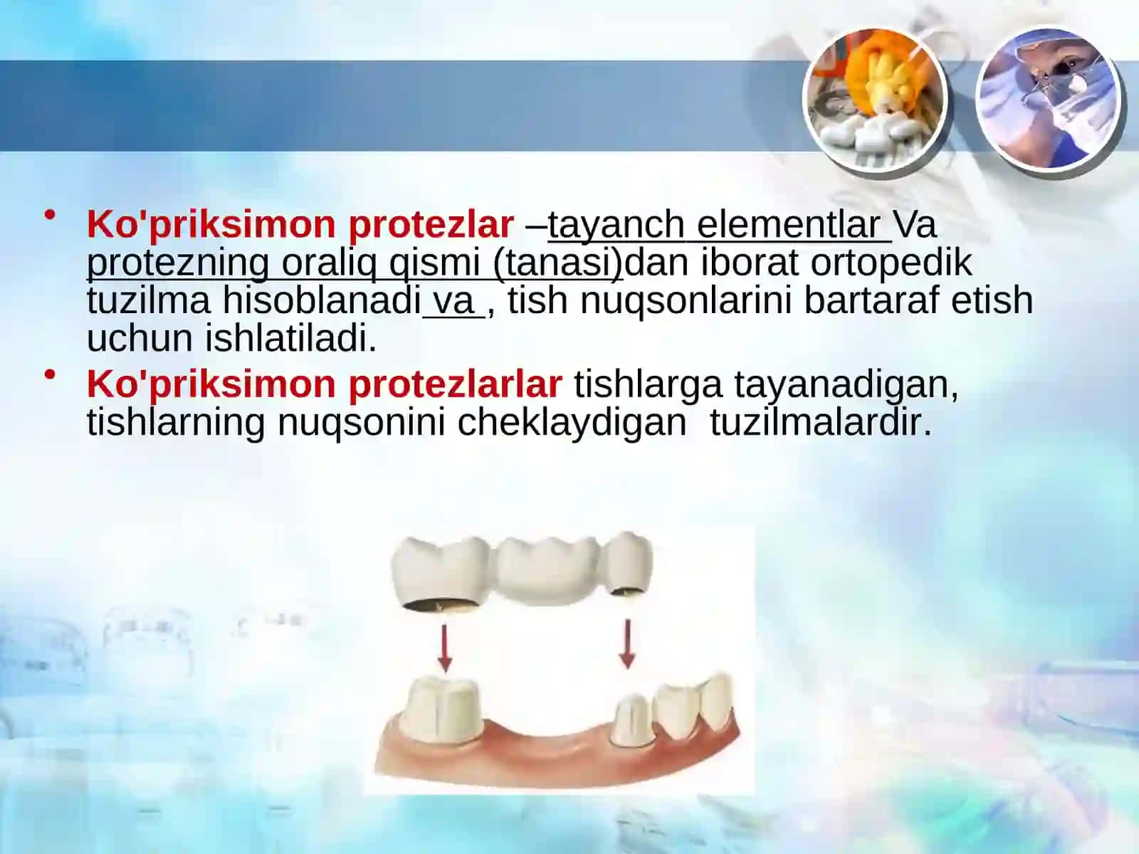 Ko'priksimon protezlar 2
