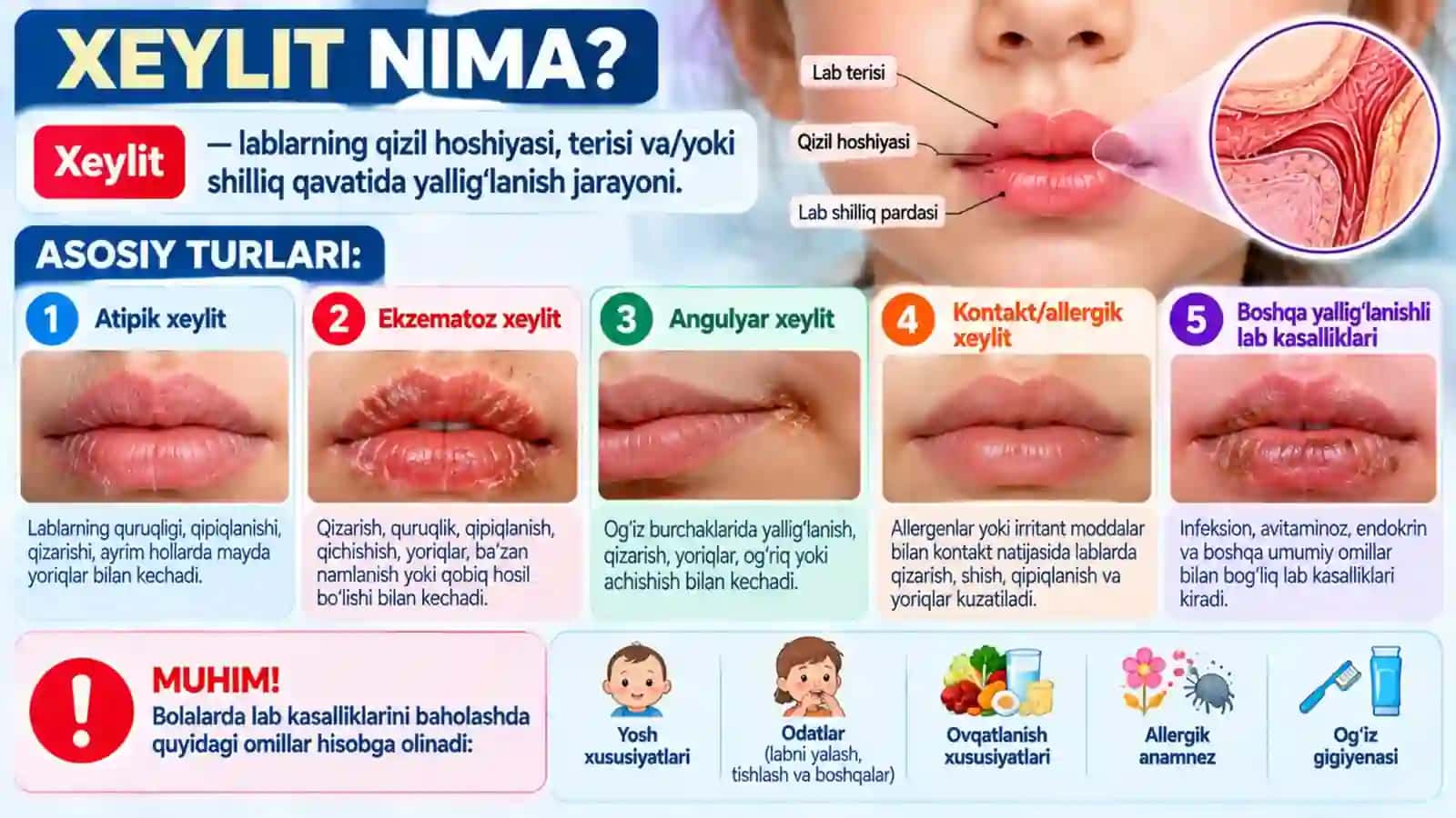 Bolalarda lab kasalliklari Atipik, Ekzematoz va Angulyar xeylitlar Klinik belgilar, tashxis, davolash va profilaktika.pptx 2