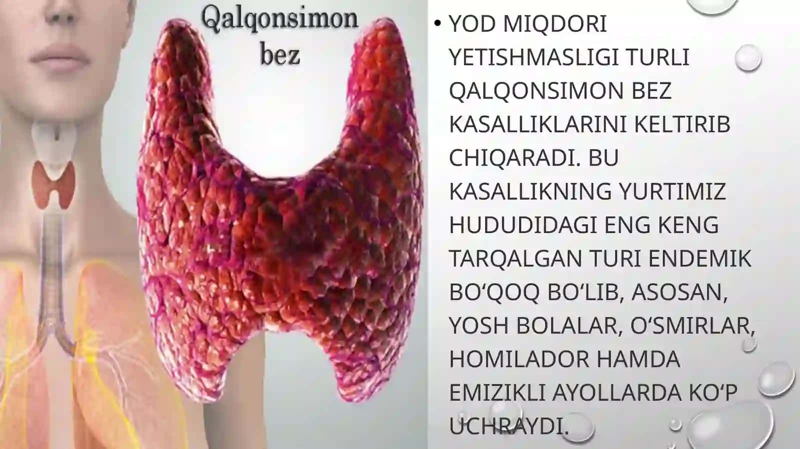 Endemik Buqoq Kasalligi 2
