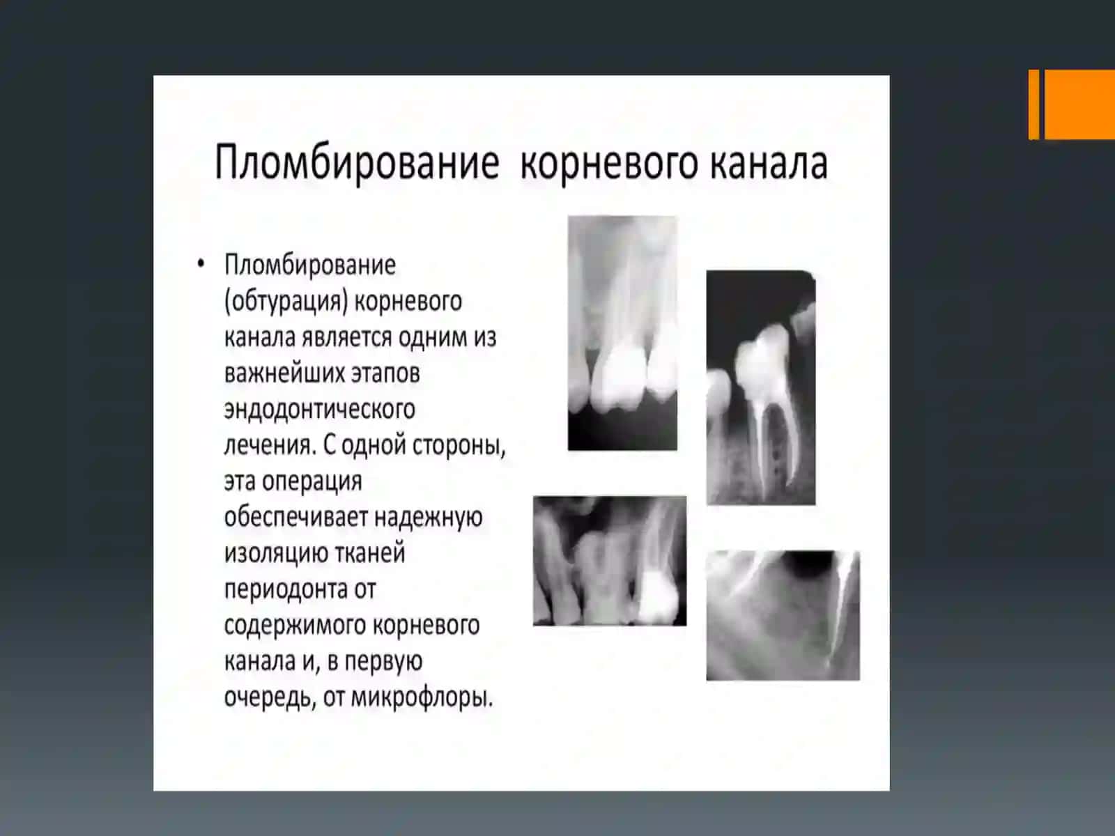 Материалы для временного и постоянного пломбирования корневых каналов 2