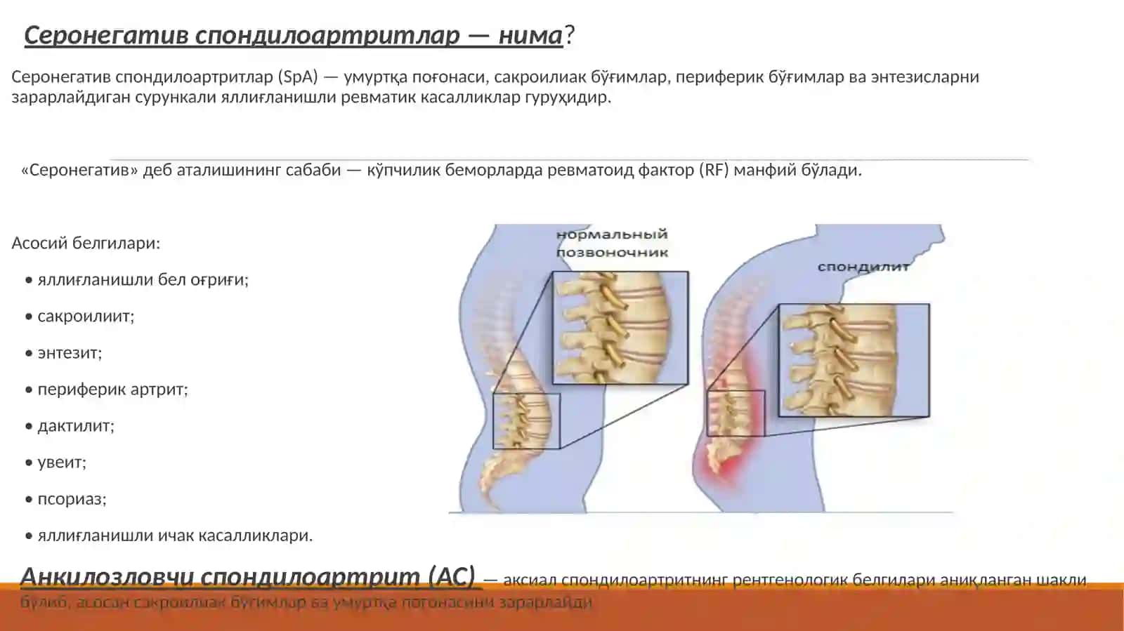Серонегативспондилоартритлар 2