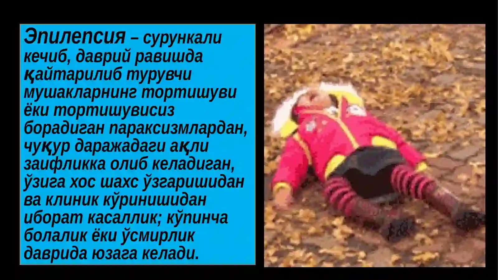 Эпилепсия касаллиги 2