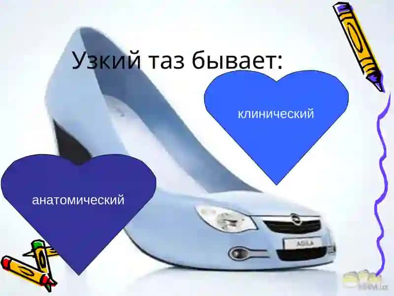 Узкий таз 2
