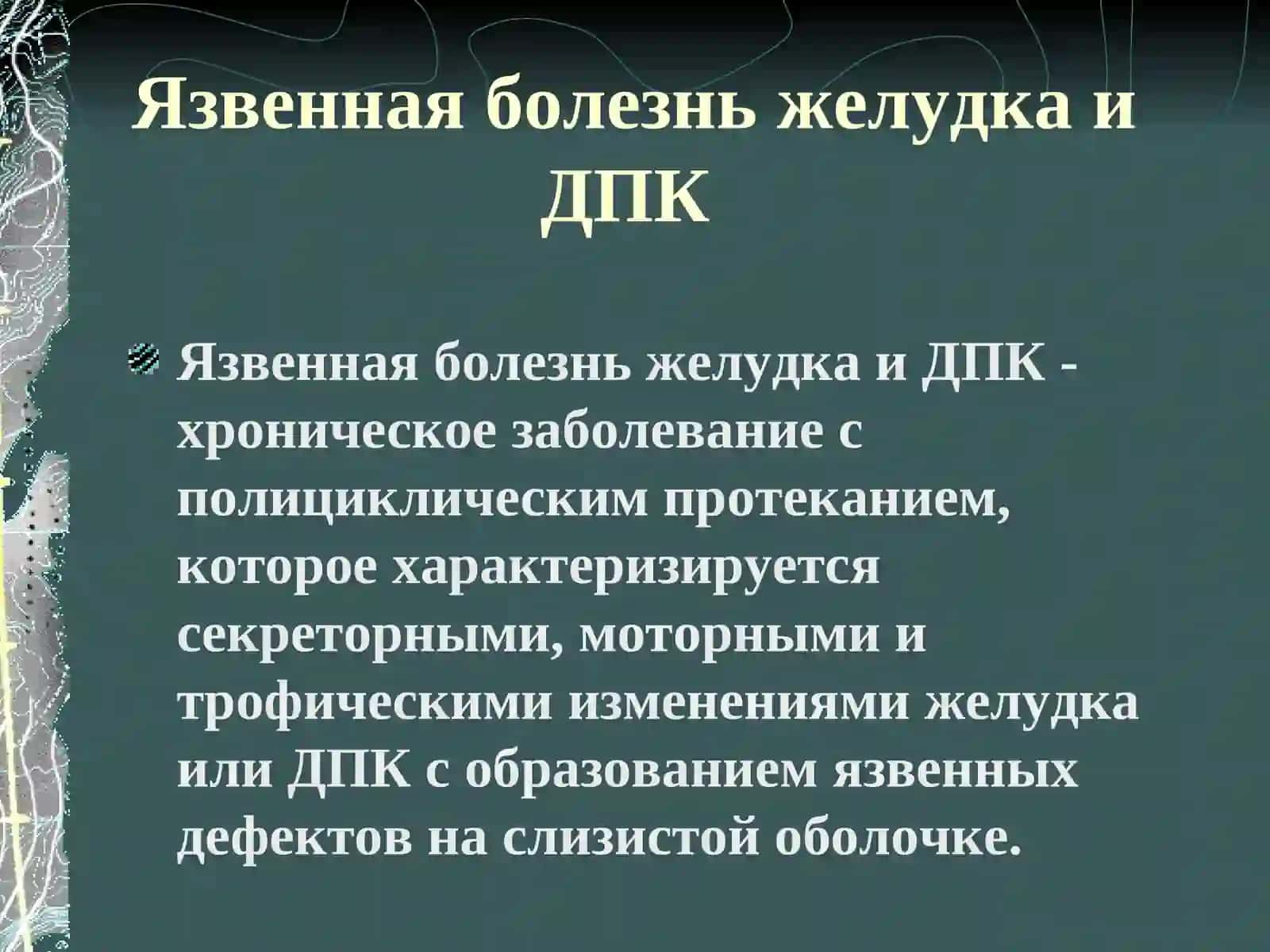 Язвенная болезнь желудка и ДПК 2