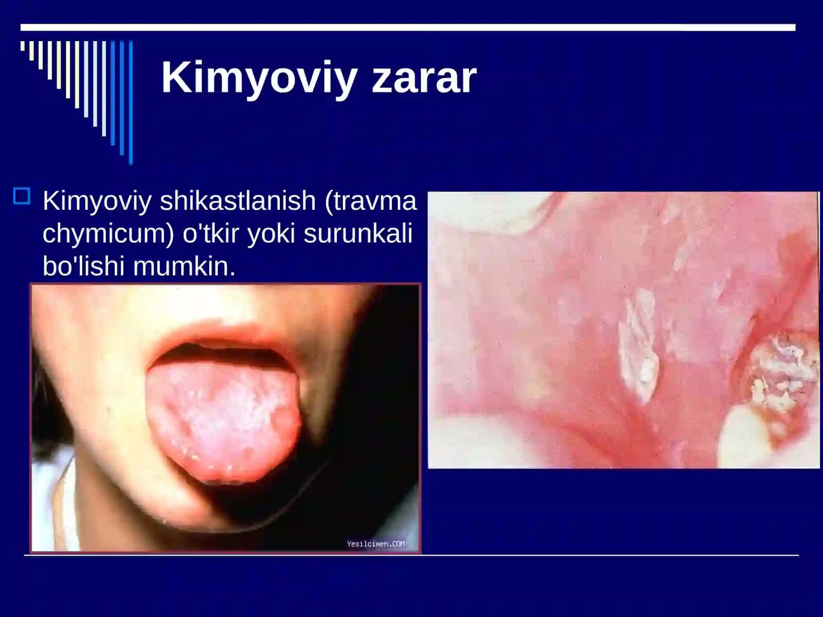 Kimyoviy shikastlanishlar klinikasi va davolash 2