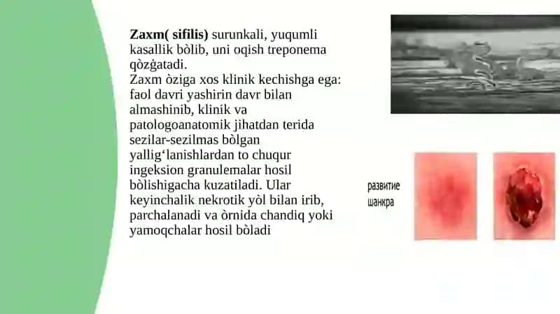 ZAXM 2
