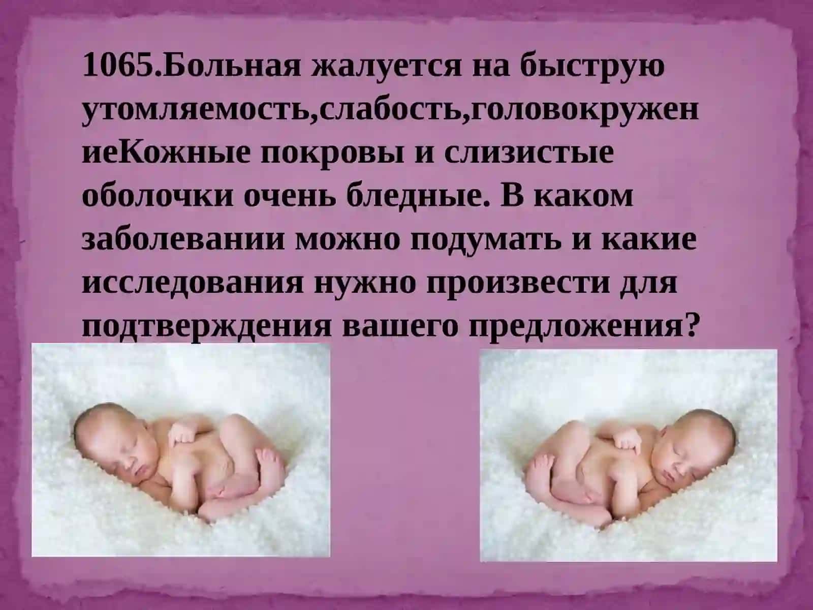 Анемии 2