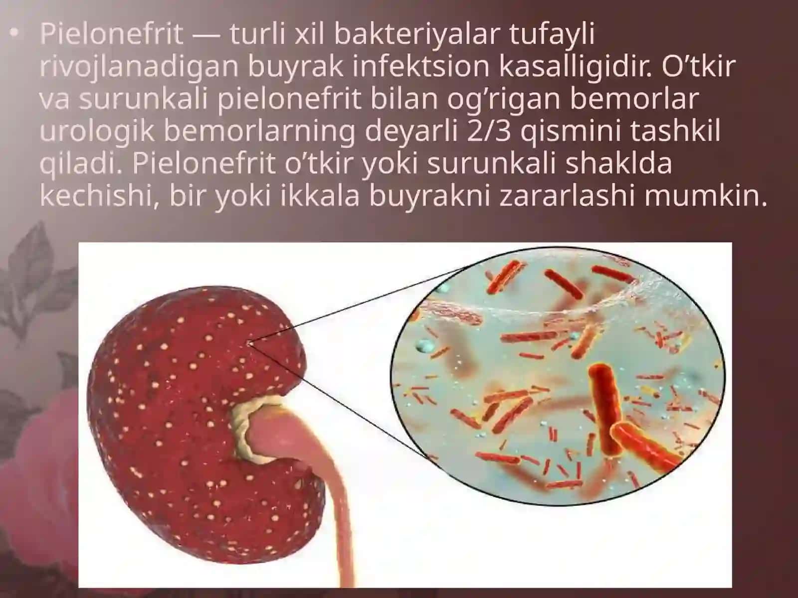 O`tkir va surunkali piyelonefrit. Simptomlari,asoratlari va davolash yo`llari. 2