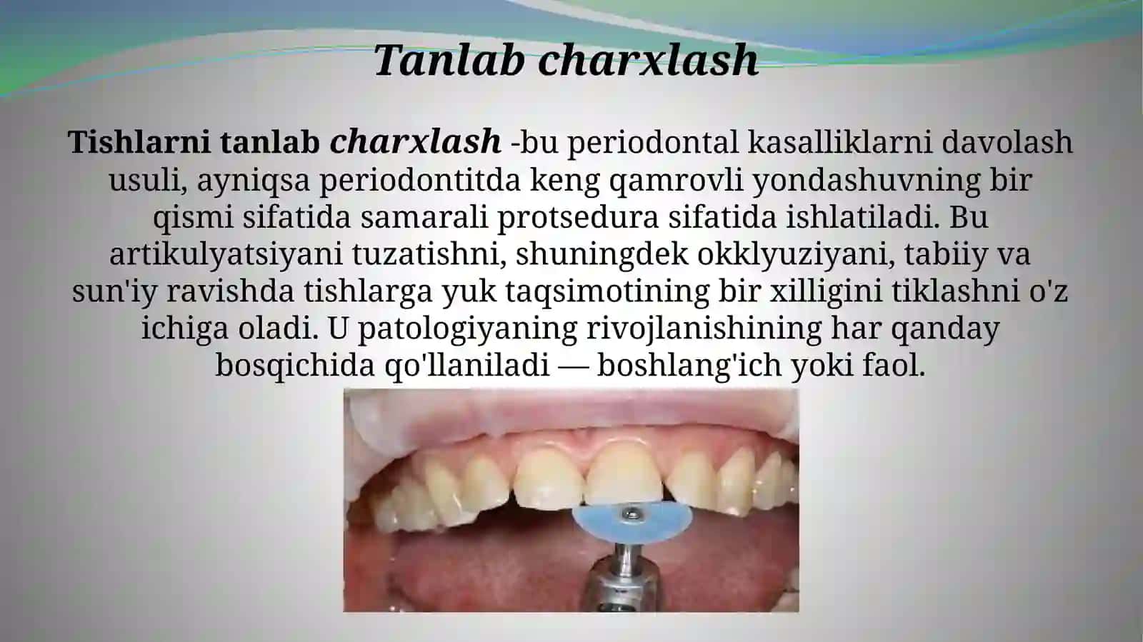 Tishlarni tanlab charxlash usuli 2