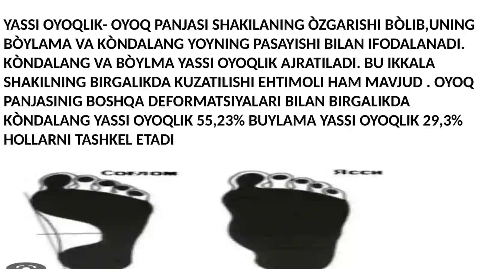 YASSI OYOQLIK 2