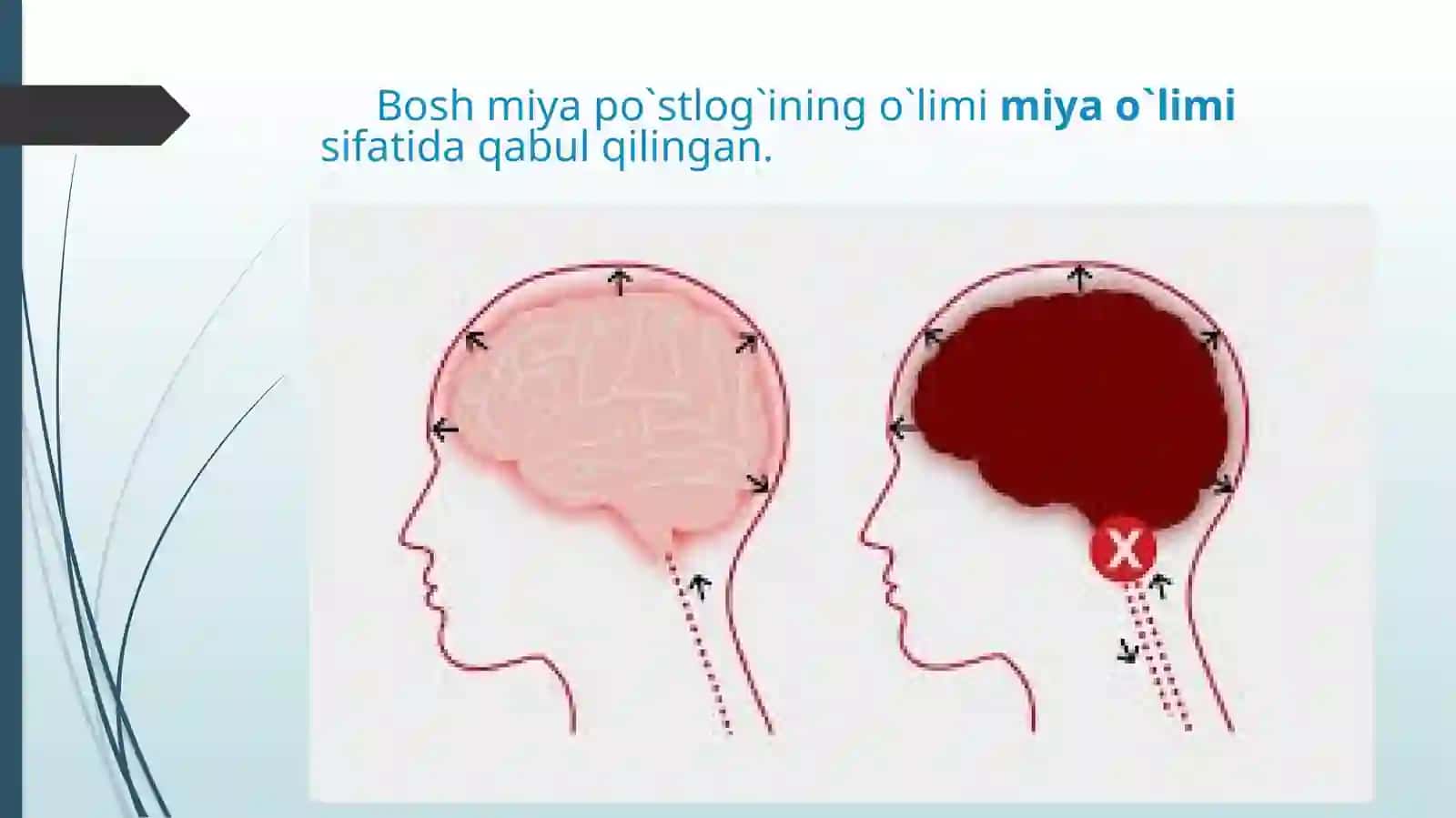 Sudtibbiyoti - Miyao`limining diagnostikasi 2