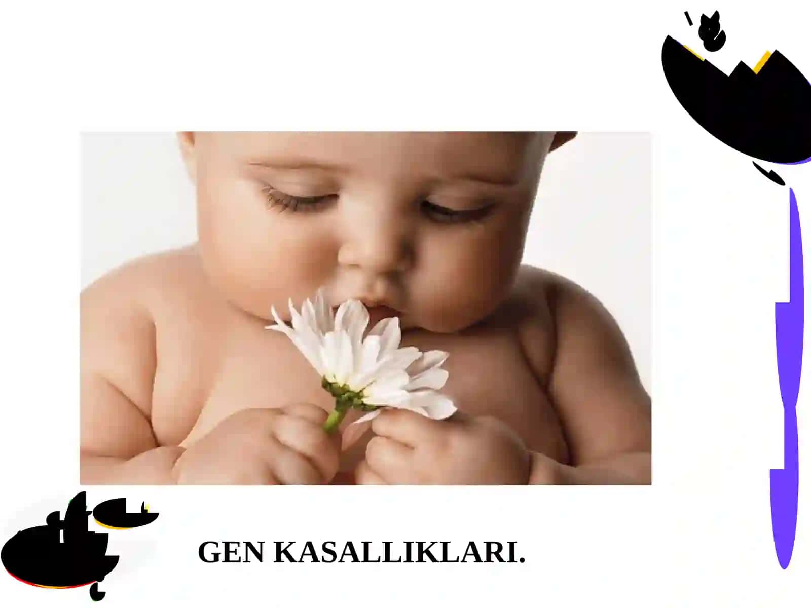Aminokislotalar almashinuvining tug'ma kasalliklari 2