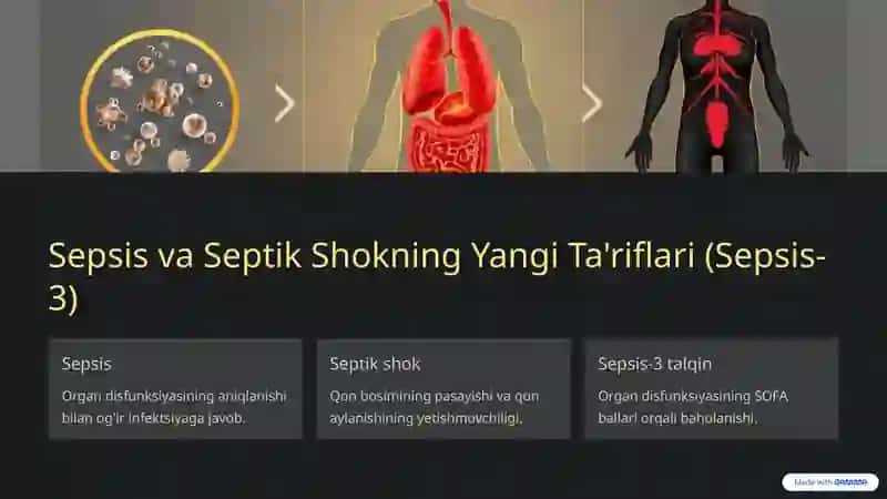 Sepsisning Zamonaviy Tasnifi 2