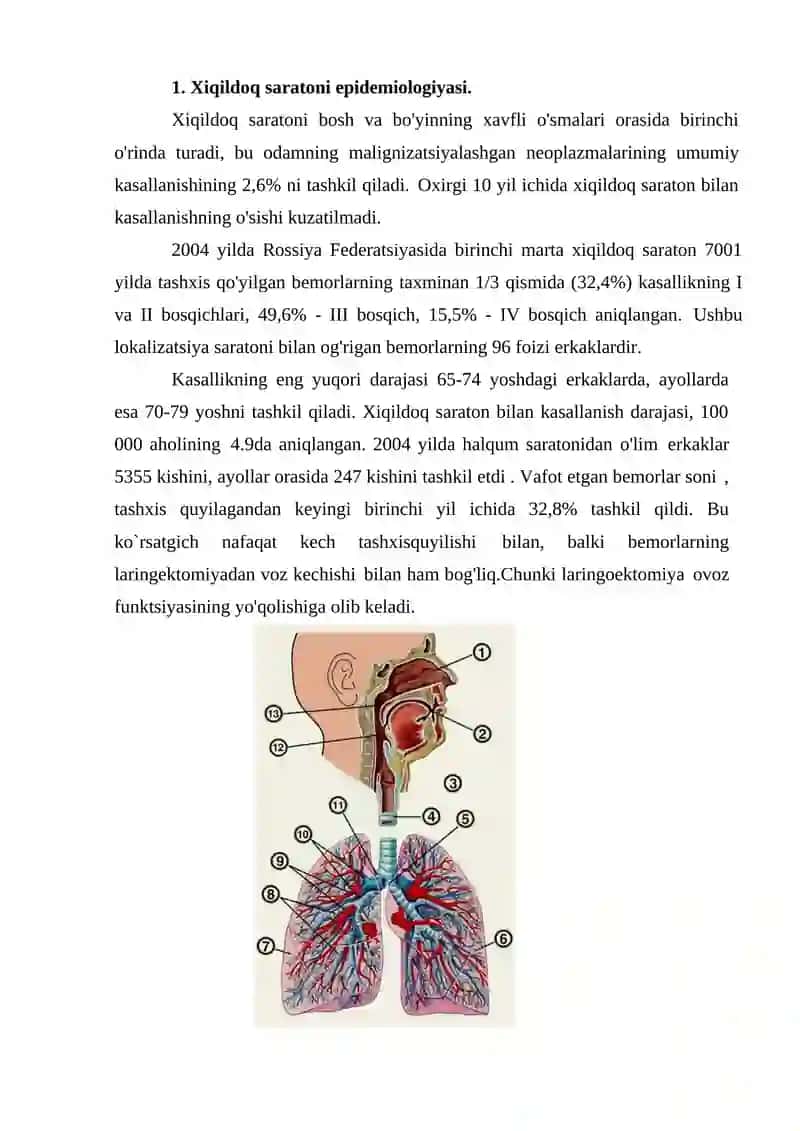Xiqildoq saratoni, diagnostikasi, etiologiyasi, davolash usullari 2