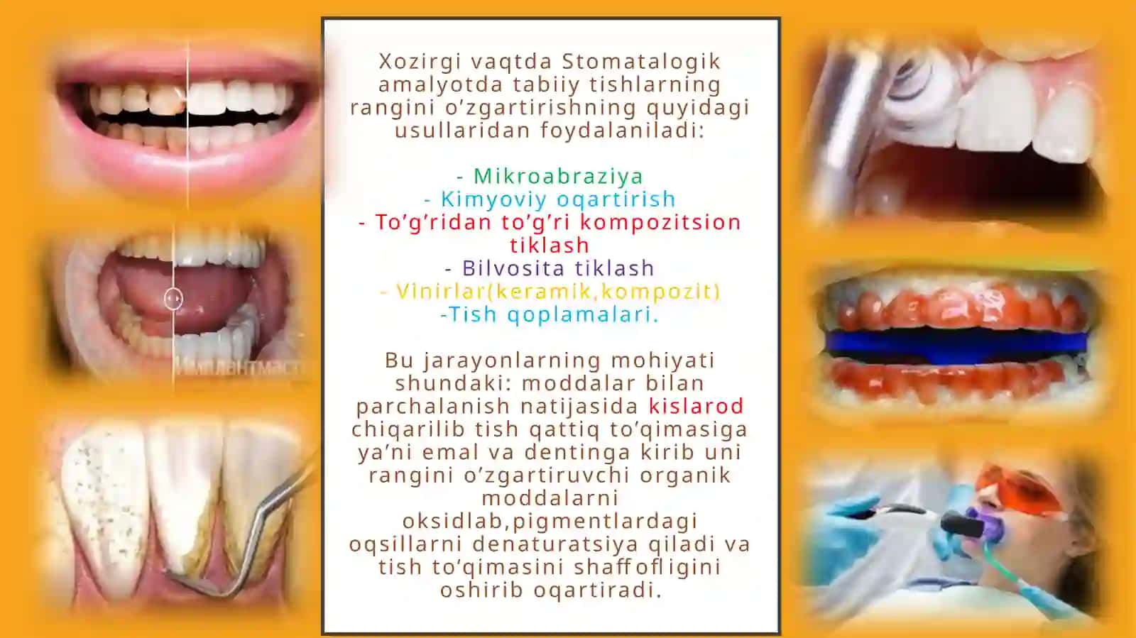 Tishlarni oqartirish usullari 2