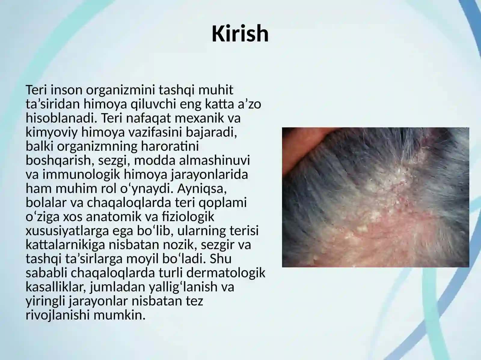 Seboreya. Pushti rangli xusnbuzarlar. Chaqaloqlarning yiringli kasalliklari 2