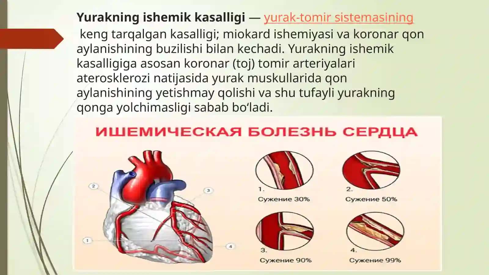 юрак ишемик касалликлари. инфаркт 2