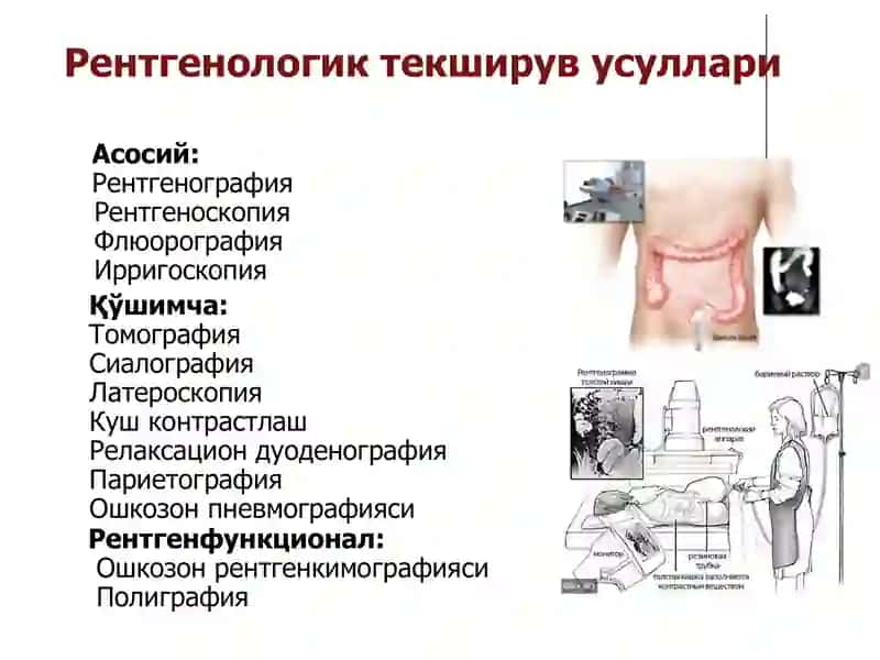 hazm tizimi Рентгенологик текширув усуллари 2