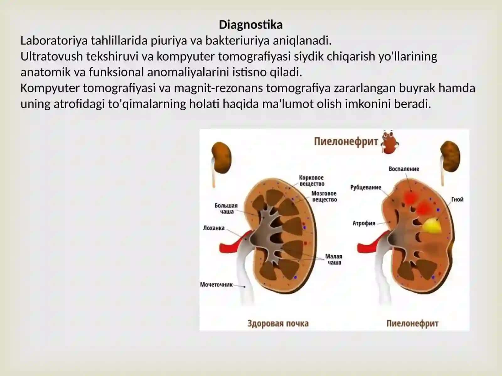 O'tkir piyelonefrit etiologiyasi, patogenezi va tasnifi 2