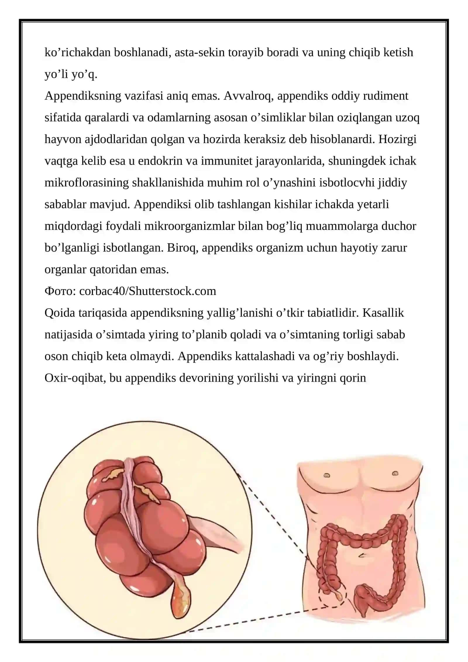 Appenditsitning yosh bollar va qariyalarda kechishi 2