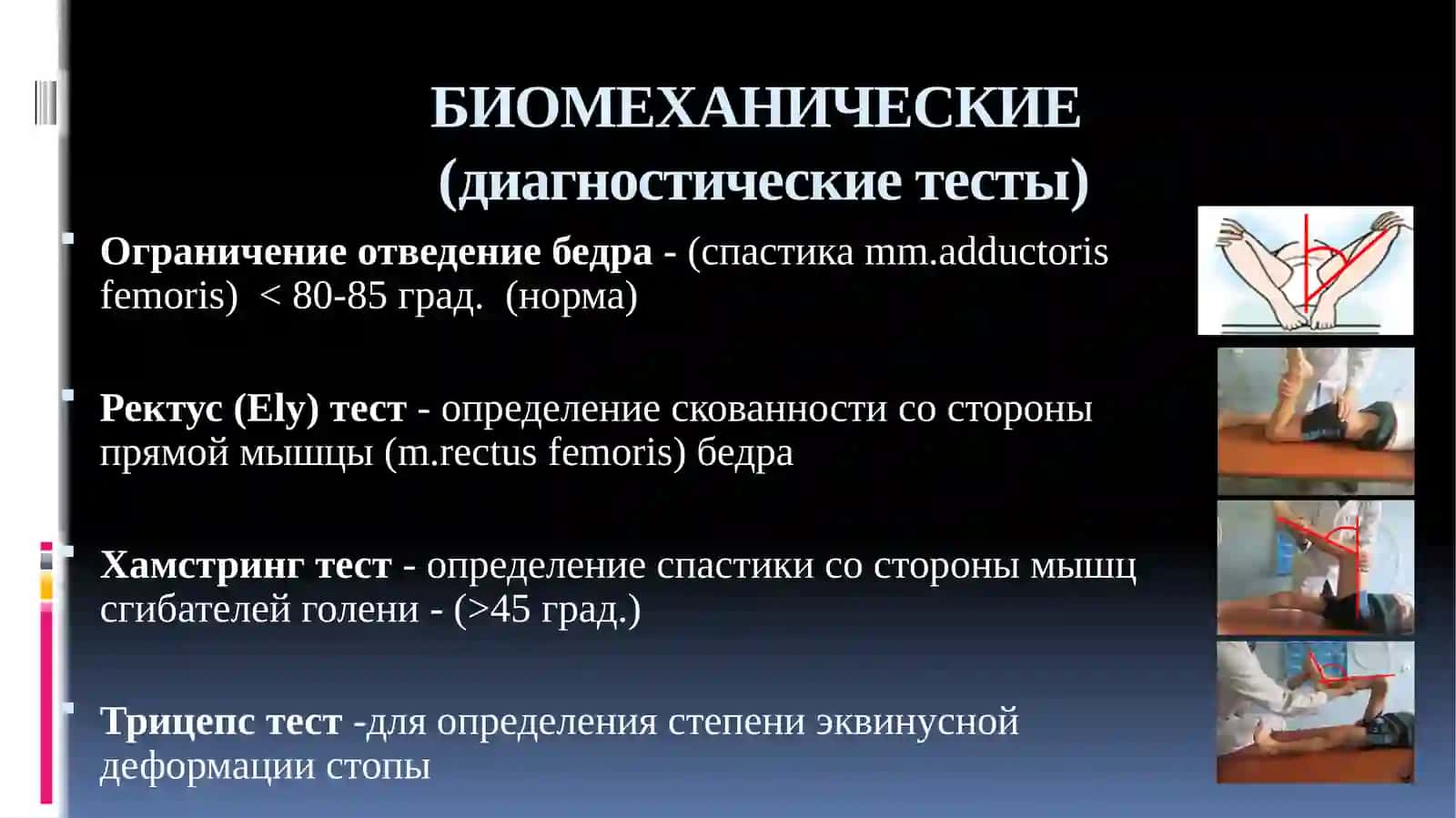 Ортопедические аспекты детского церебрального паралича 2