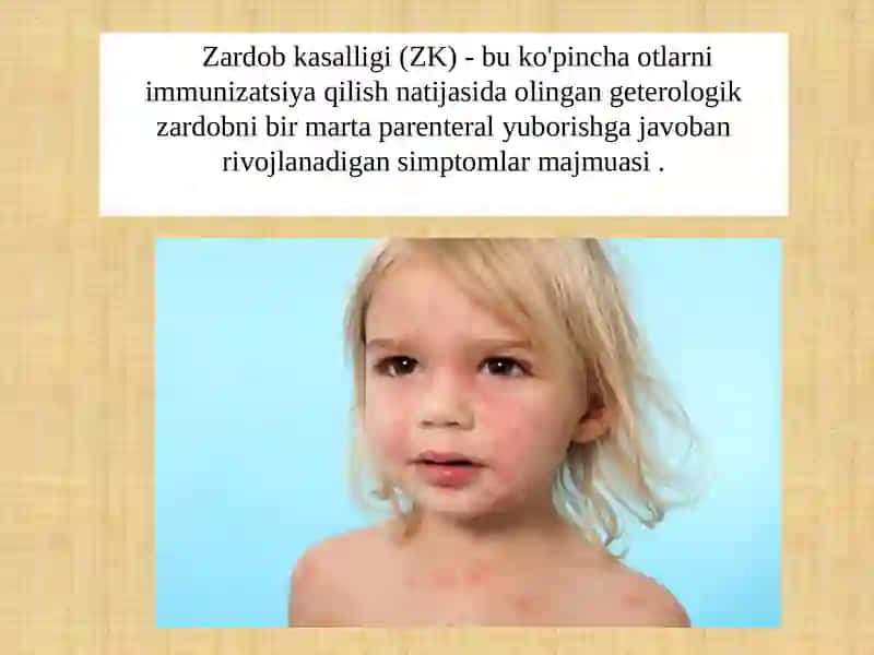 Zardobkasalligi 2