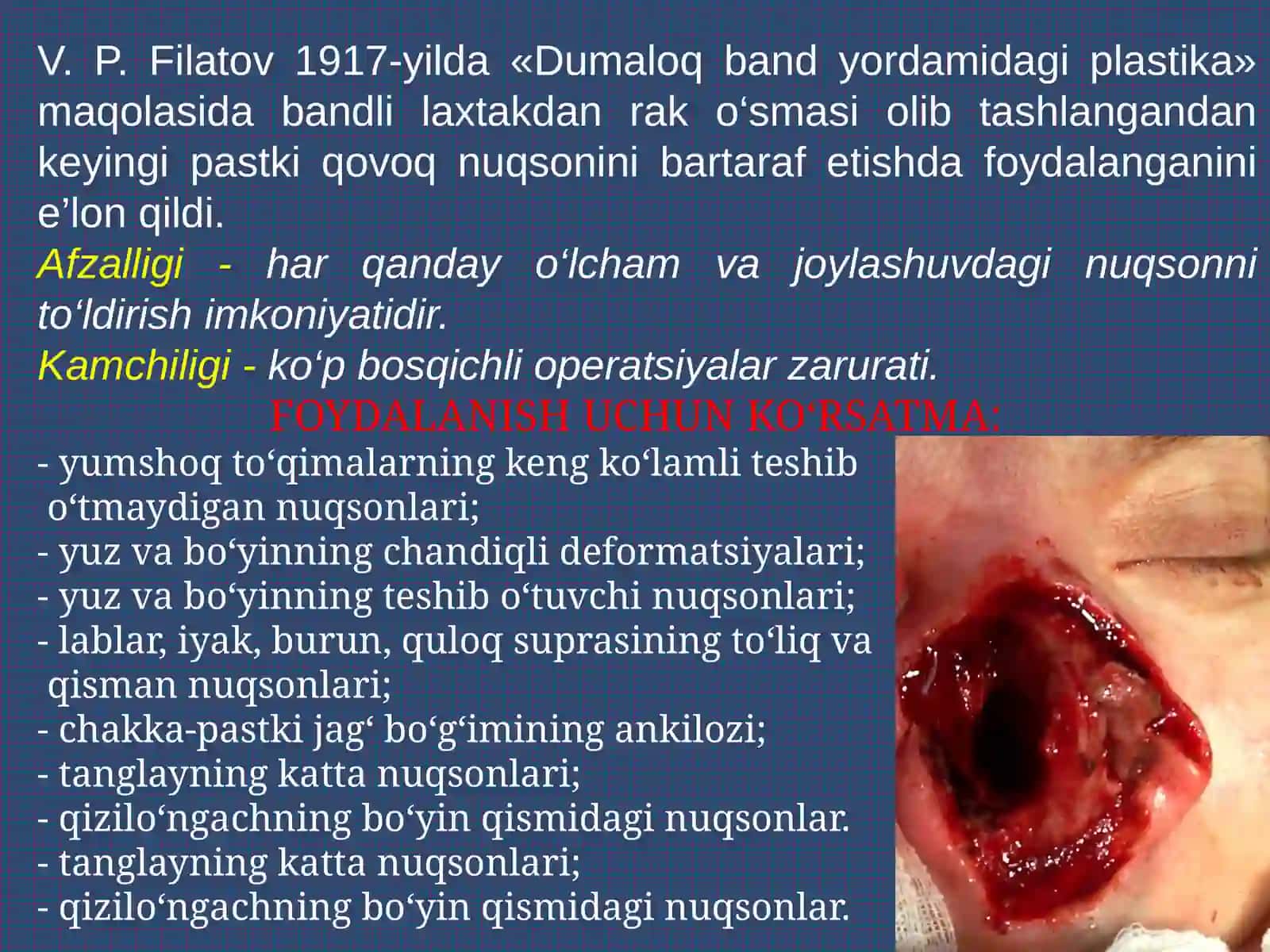 Filatov bandi bilan plastika qilish: Filatov bandini tayyorlashga ko'rsatmalar. Bandni nuqson sohasiga migratsiya qilish bosqichlari. Bandni yoyish. Asoratlar. 2