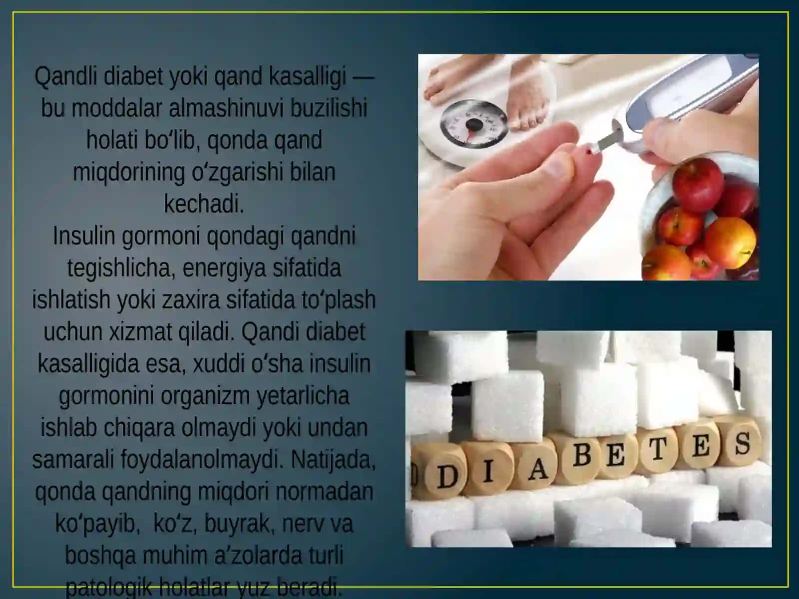 Qandli diabet 2
