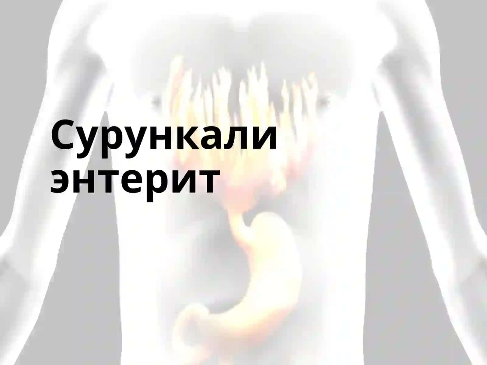 СУРУНКАЛИ ЭНТЕРИТ ВА КОЛИТЛАР 2