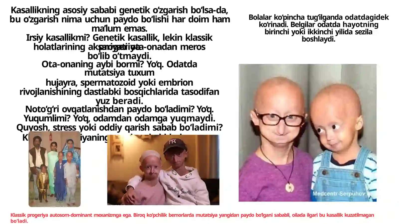 Progeriya 2