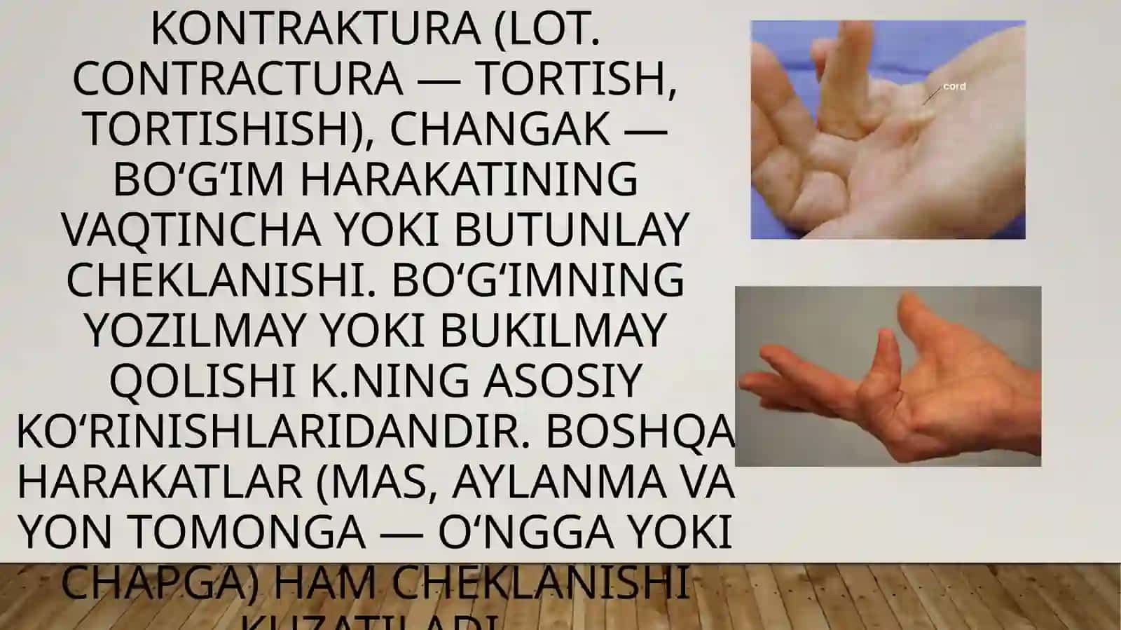 Bo‘g‘imlar kontrakturalari 2