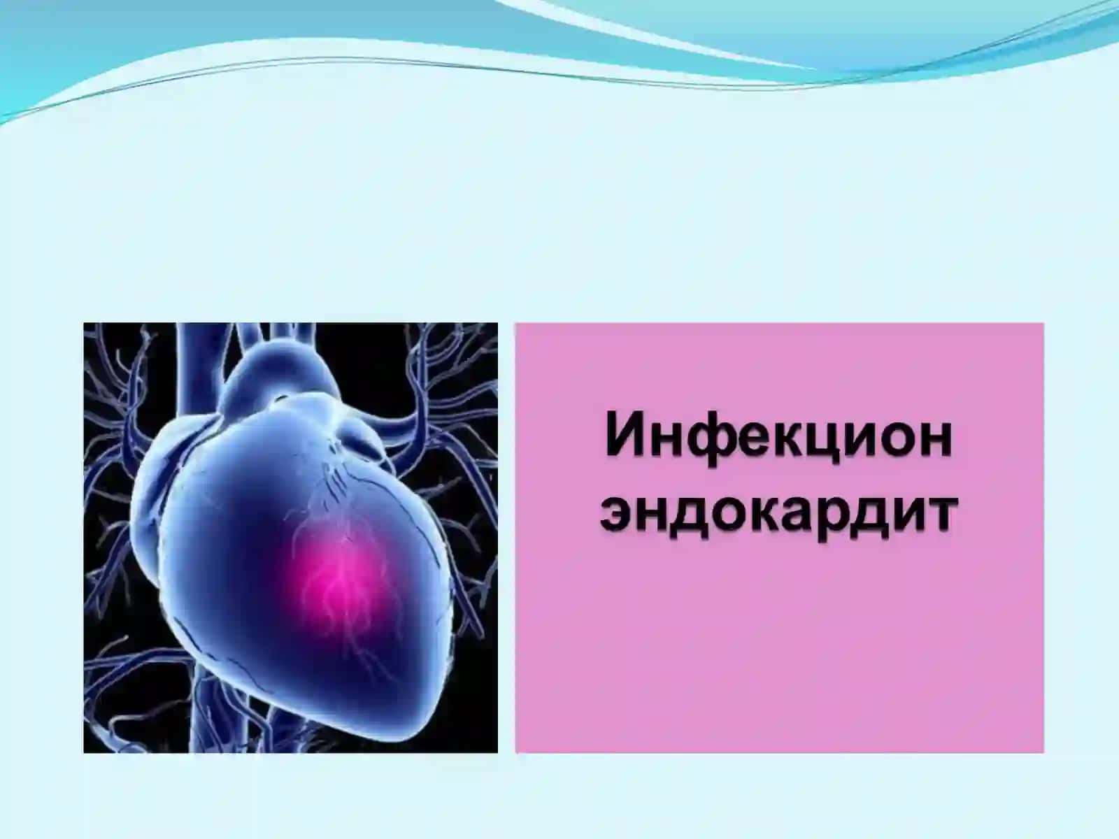 Infekstion endokardit 2