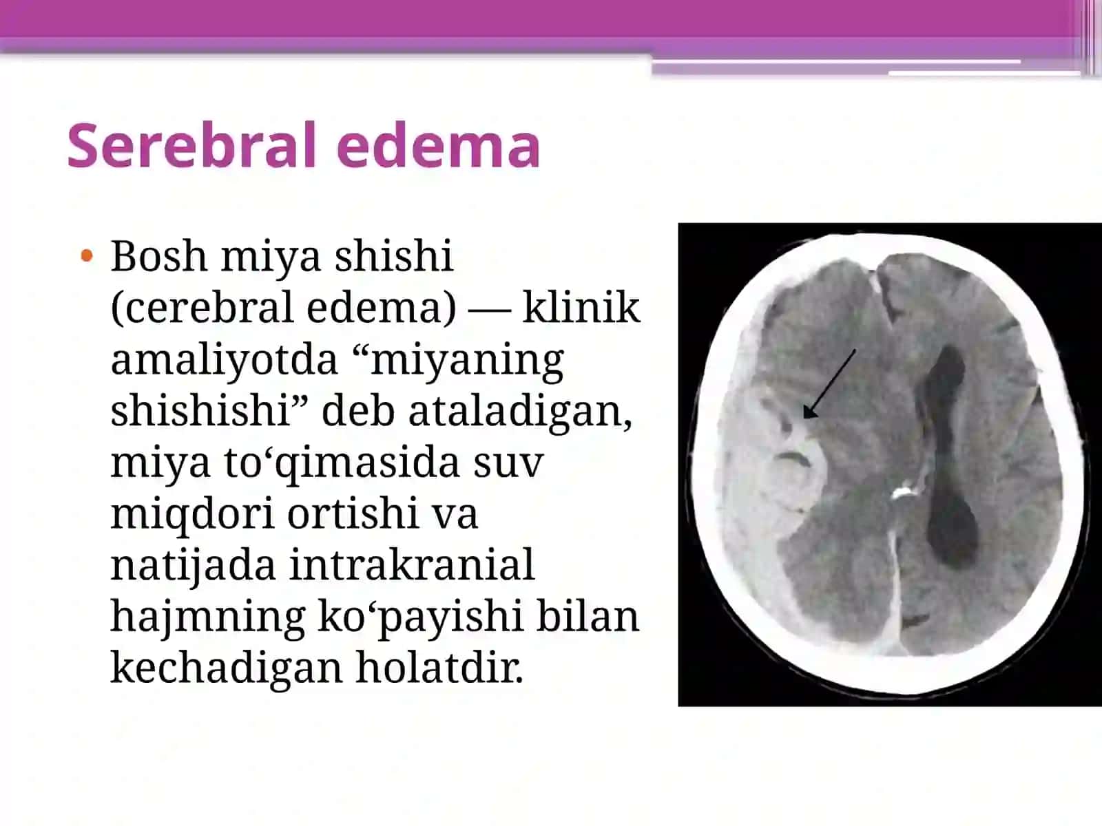 Bosh miya shishi 2