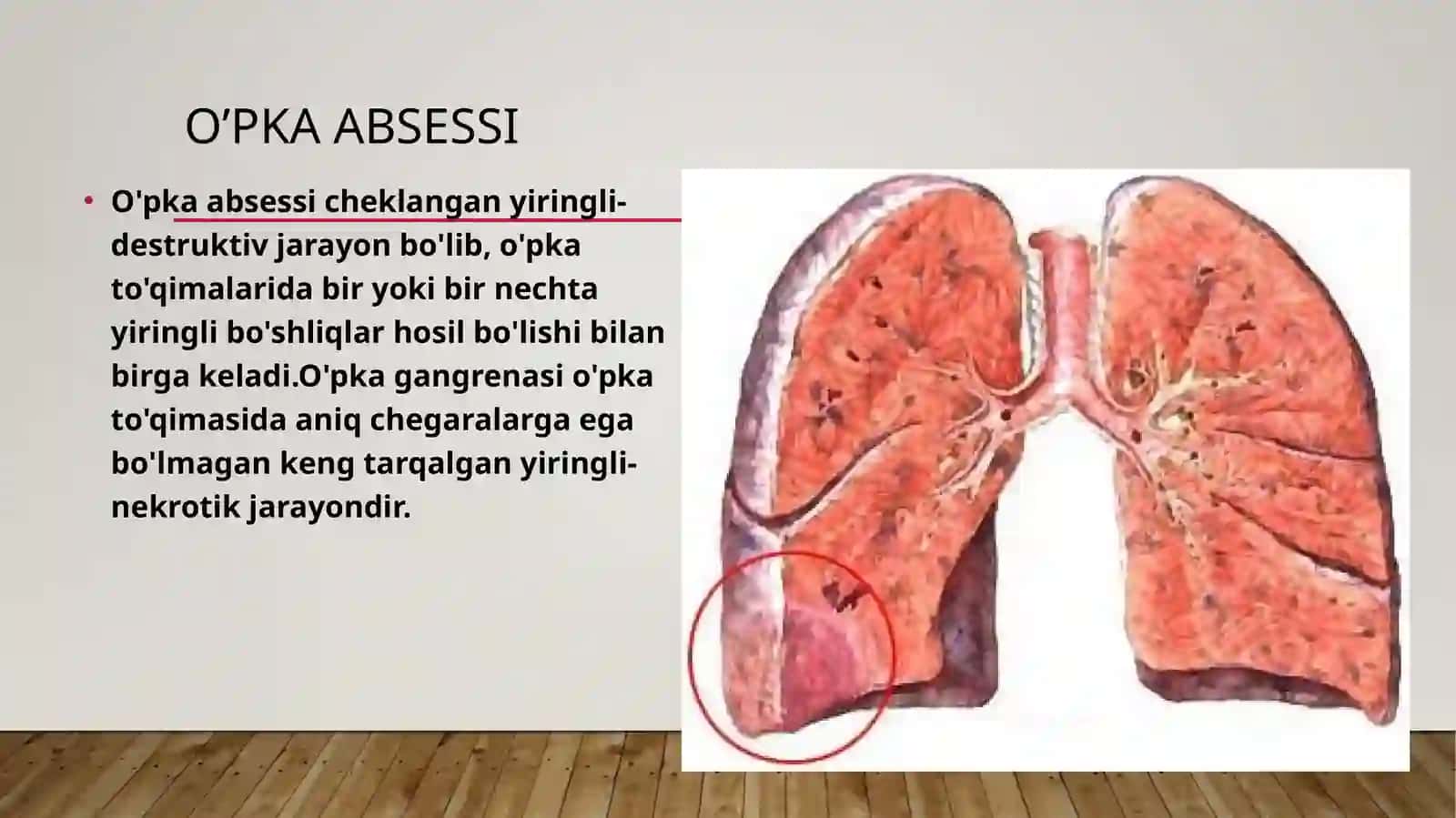 O’PKA ABSESSI VAGANGRENASI 2