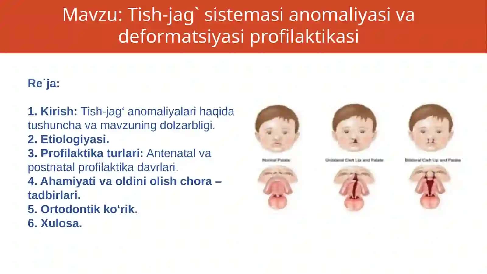 Tish-jag` sistemasi anomaliyasi va deformatsiyasi profilaktikasi 2