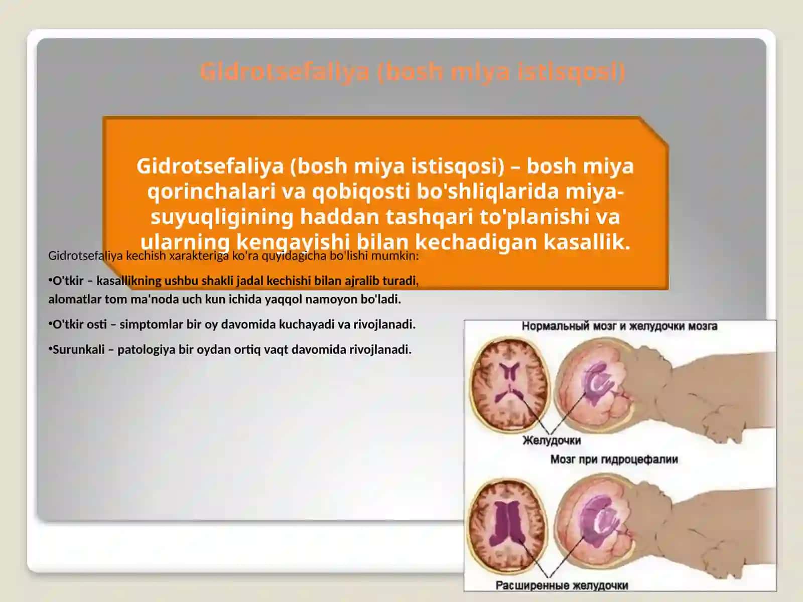 Gidrosefaliya (bosh miya istisqosi) diagnostikasi va klinikasi 2