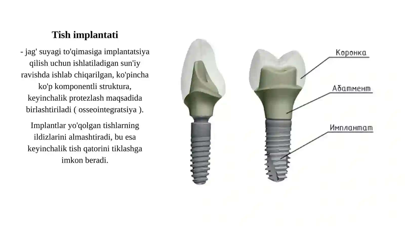 Tish implantati osteointegratsiya bosqichlari 2