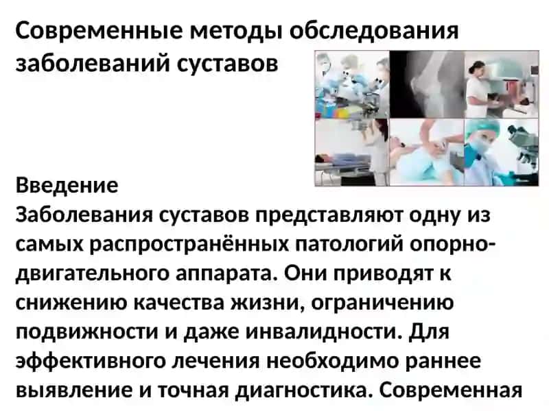 Современные методы обследования заболеваний суставов. Сравнительный анализ суставного синдрома. Современные методы исследования диффузных заболеваний соединительной ткани. 2