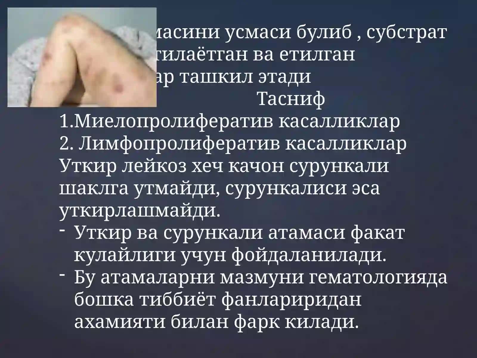 Сурункалилейкозлар 2