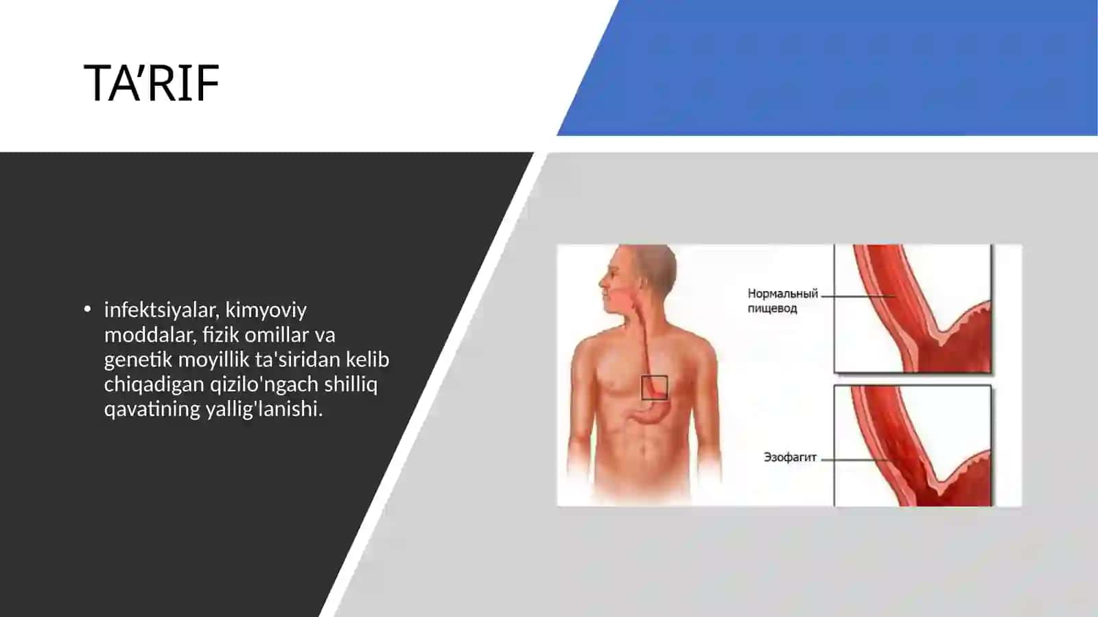 EZOFAGIT 2