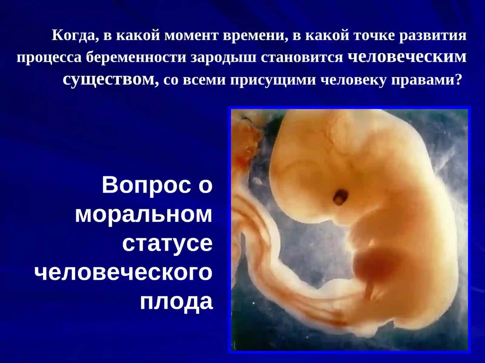 Моральный статус эмбриона 2