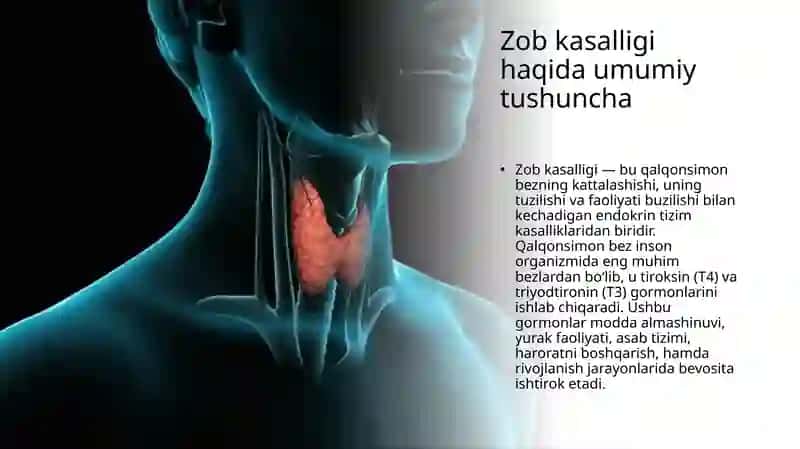 Zob kasalligi 2