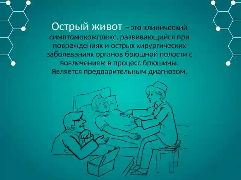 Острый живот 2