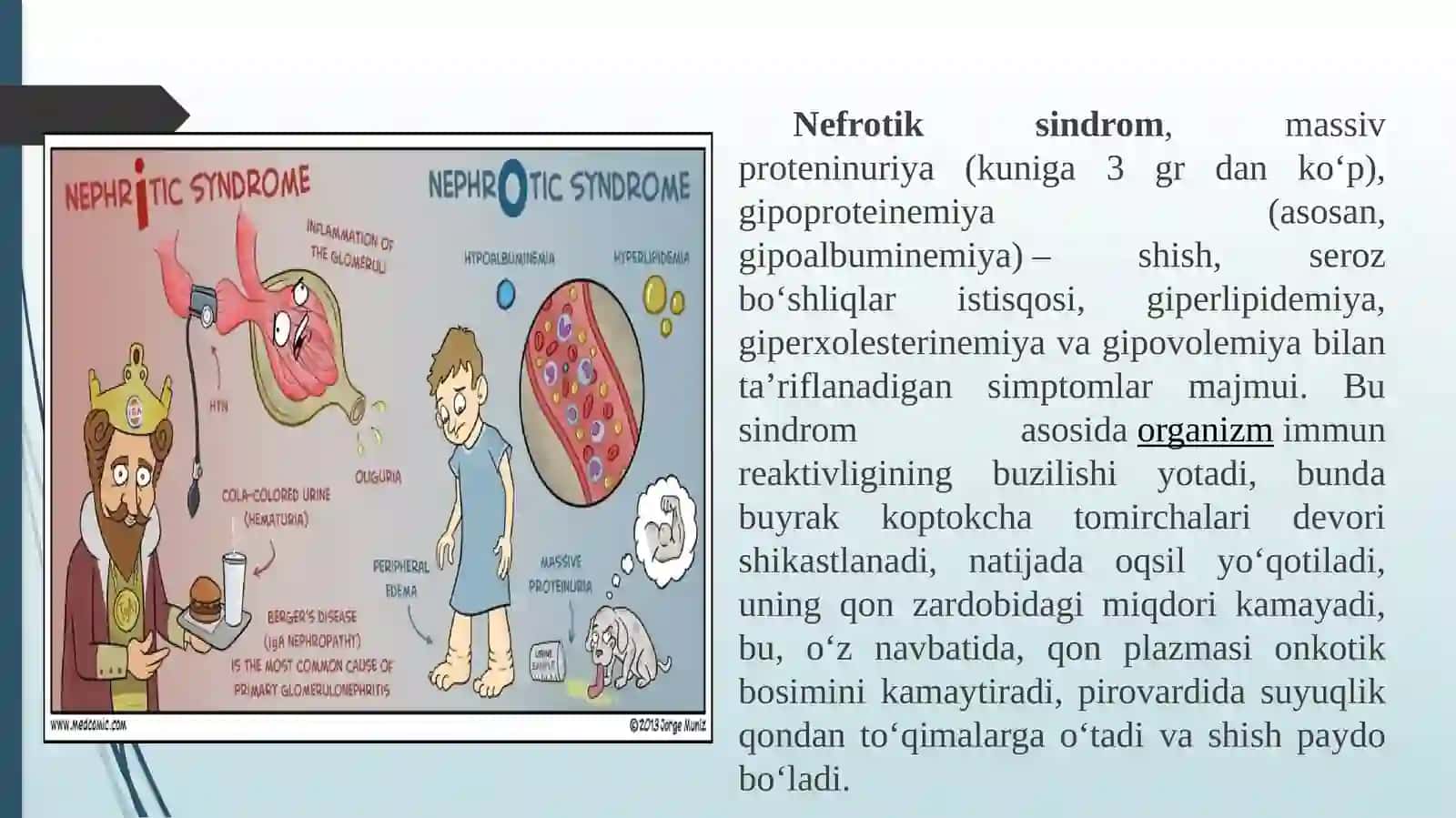 Nefrotik sindrom 2